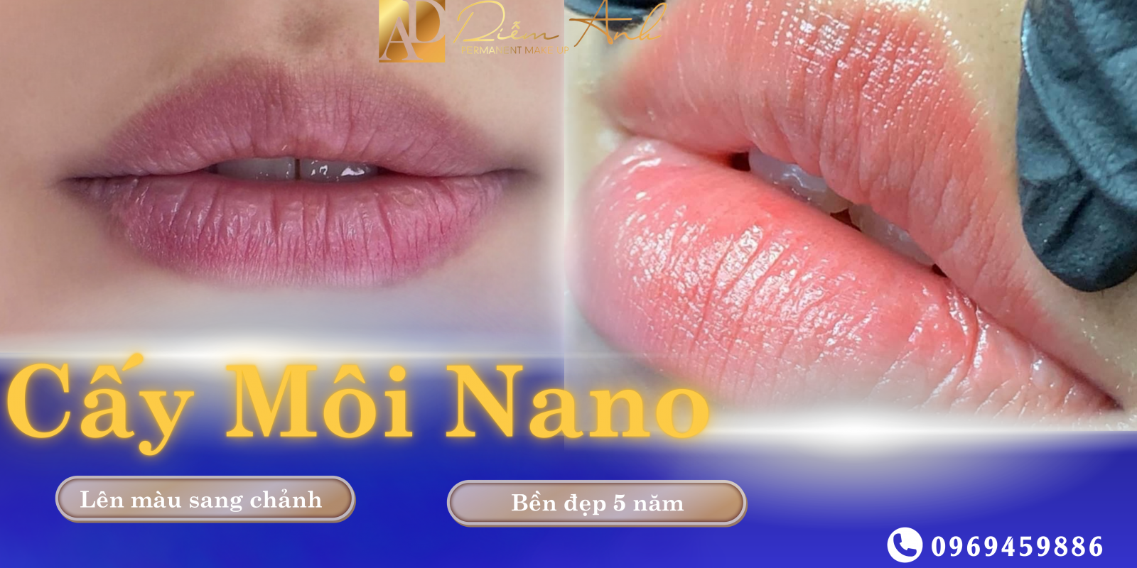 khu tham moi