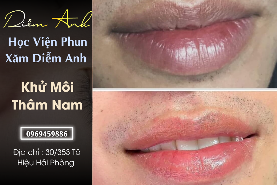 Nguyen nhan gay ra tham moi o nam gioi tai Hai Phong hien nay