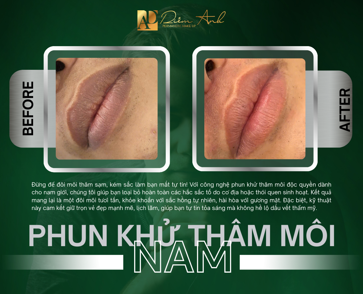 khach-hang-nam-khu-tham-moi-tai-phun-xam-diem-anh