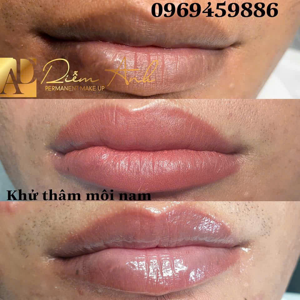 khu tham moi nam