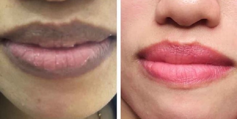 Đia chi trị tham moi nam gioi tai Hai Phong 