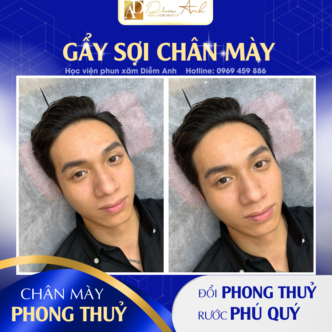 Gẩy sợi lông mày nam