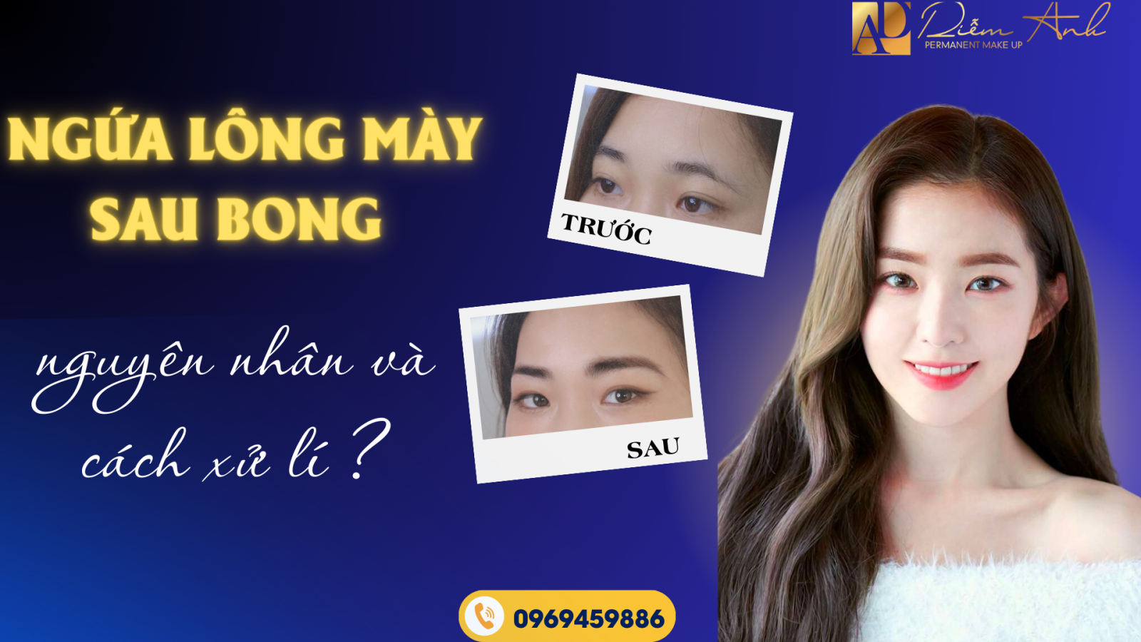 ngua long may sau bong
