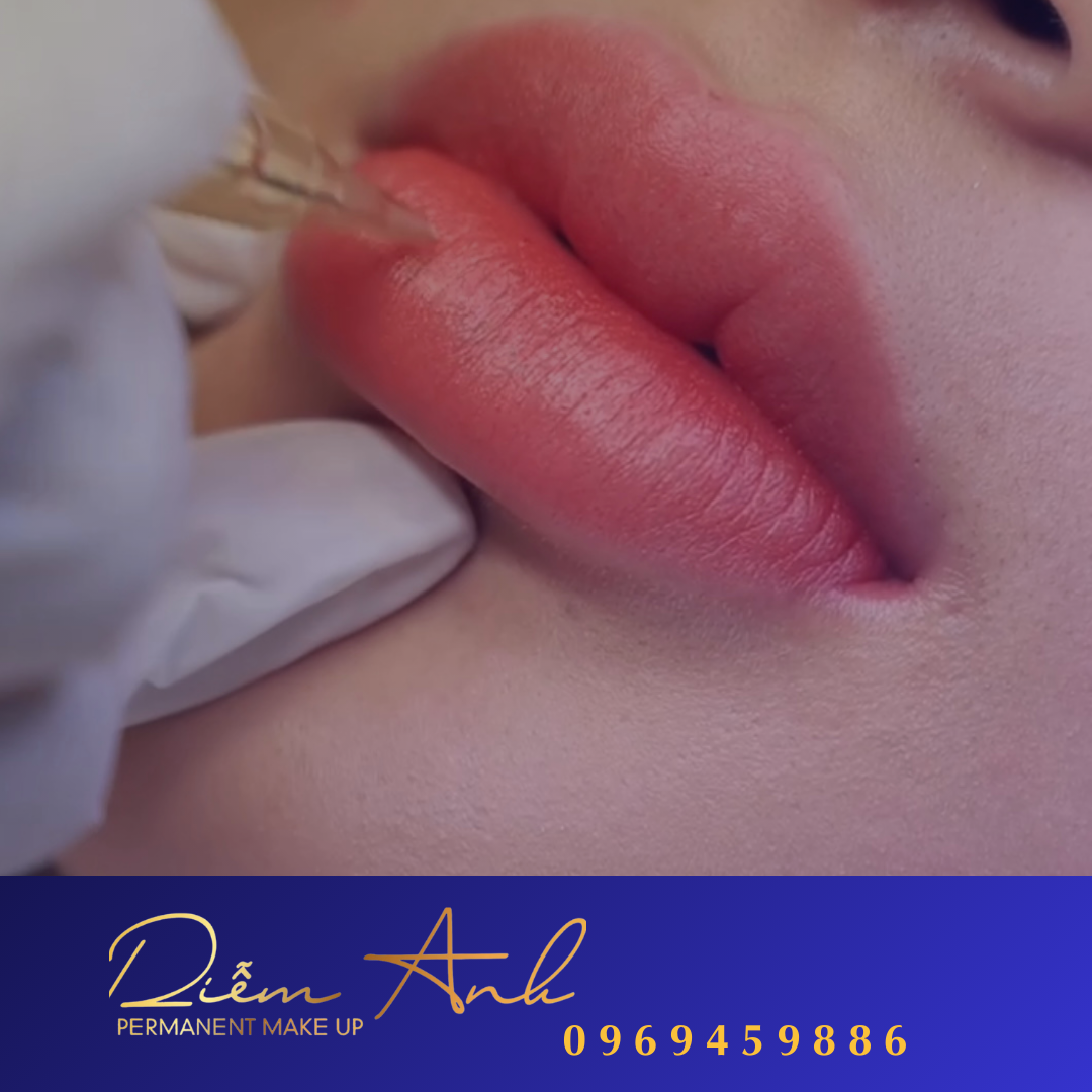 phun-moi-collagen-hai-phong-diem-anh