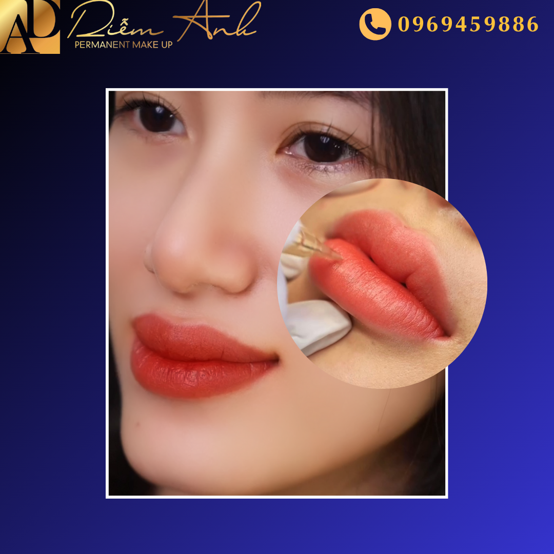 phun-moi-collagen-hai-phong-diem-anh