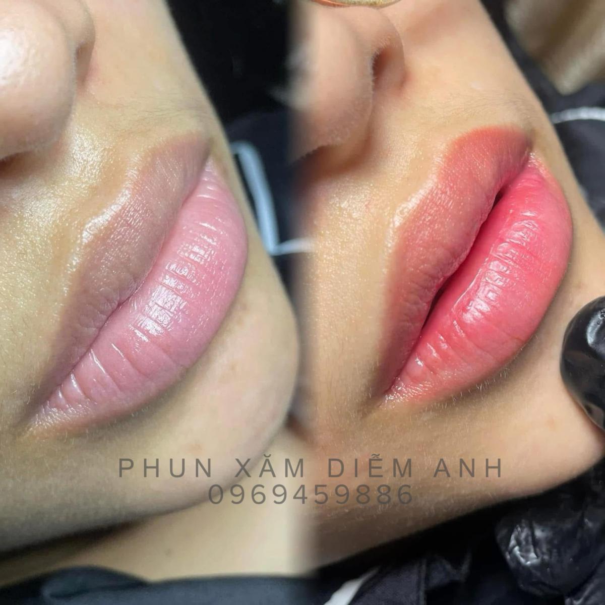 phun-xam-diem-anh