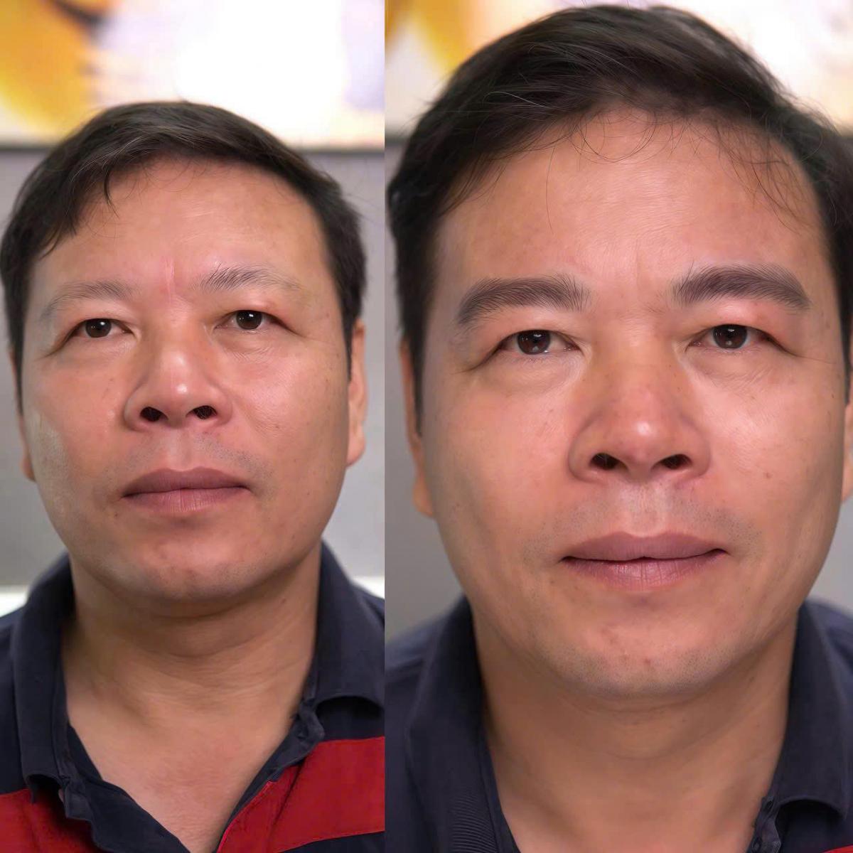 phun xam long may nam