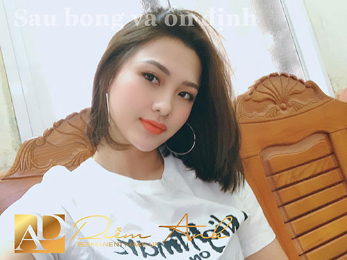 khach hang phun moi tai diem anh