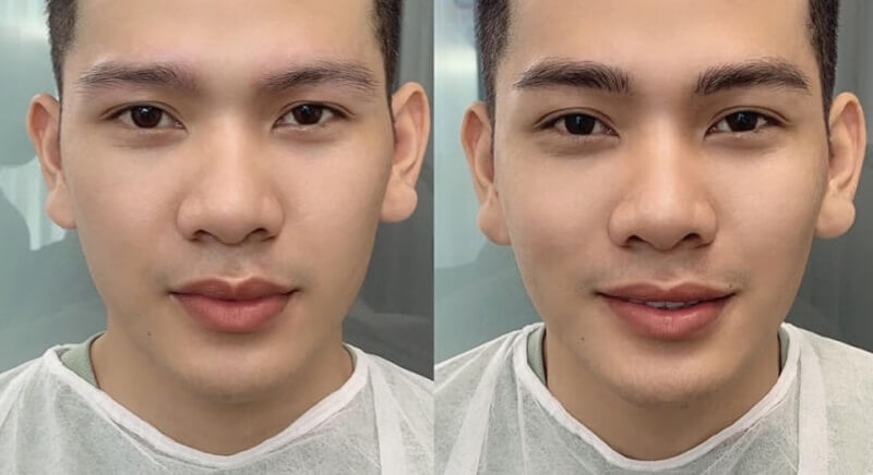 master Diễm Anh gẩy sợi số 1 Hải Phòng 