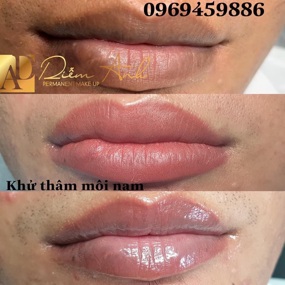 Quy trinh phun khu tham moi nam tai phun xam Diem Anh