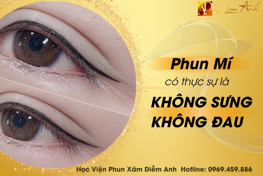 uu điem cua phun mi mat tren tai Hai Phong