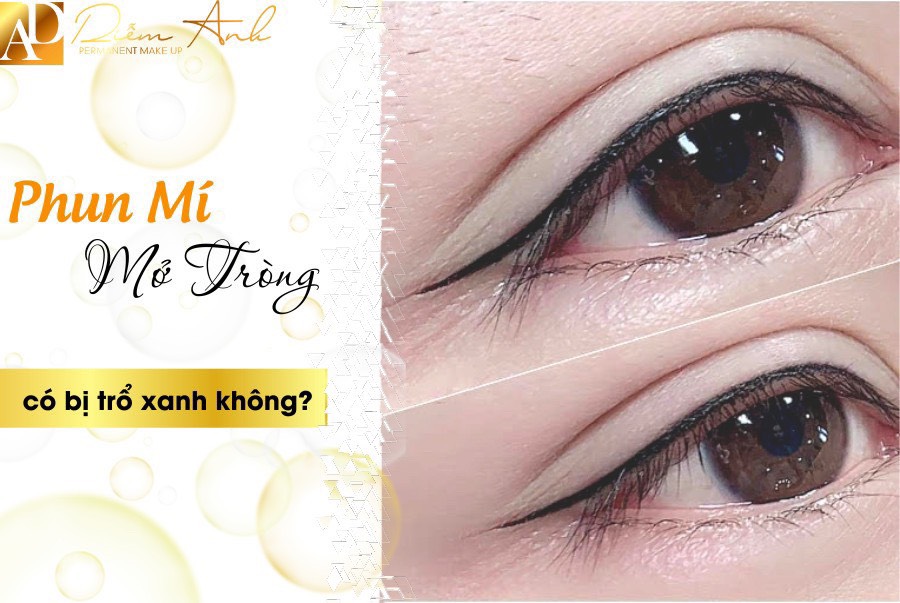Nhung vi tri phun mi mat đuoc nhieu chi em lua chon o Hai Phong
